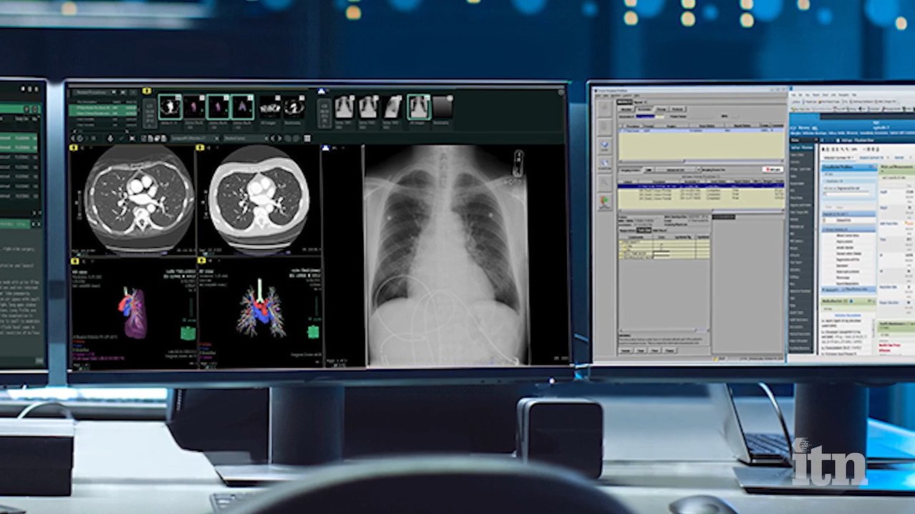 Advancements in Radiology: Transforming Medical Imaging in 2025
